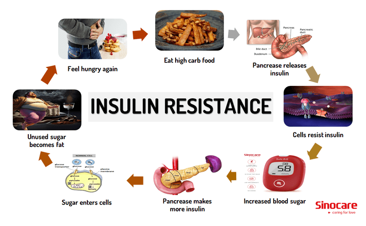 insulin_resistance_sinocare